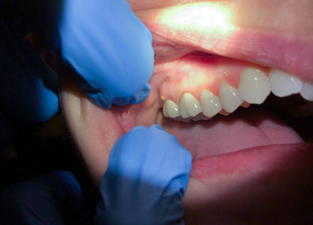 Best Same-Day Emergency Dental Services in Shavertown, PA