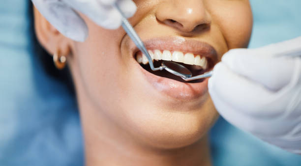 Best Emergency Tooth Extraction in Shavertown, PA